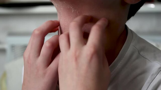 Child scratching irritated neck and collarbone with atopic dermatitis. Skin peeling and itching