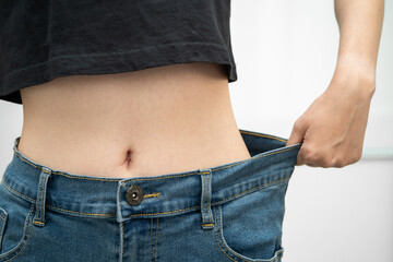 Young Asian woman losing weight wearing loose pants in oversize jeans.