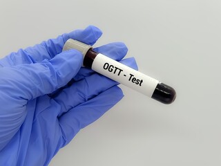 Naklejka premium Doctor holding a test blood sample for OGTT- test. Laboratory medical testing concept. . 