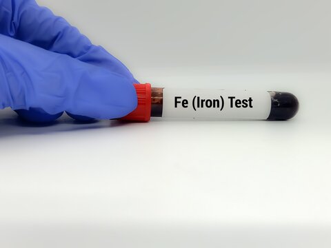 Doctor  holding a test blood sample for Fe(Iron) - test. Laboratory medical testing concept. . 