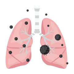 Pneumonia Illustration