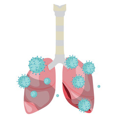 Pneumonia Illustration
