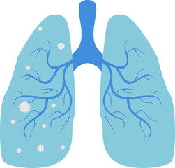 Pneumonia Illustration