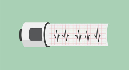 An ECG machine prints out a heart rhythm reading on graph paper