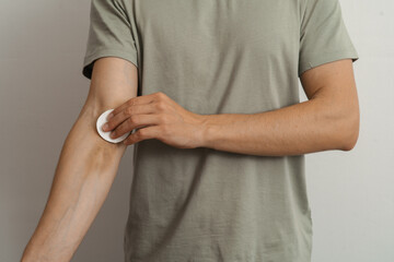 Man disinfecting a bruised forearm with a cotton pad