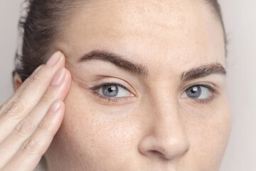 Close-up portrait of Caucasian middle-aged woman pointing to the wrinkles on the upper eyelid. Signs of aging on the face close up