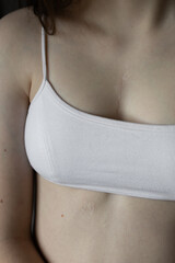 girl in white top with scar from heart surgery. Concept of medicine, health, beauty, psychology.
