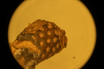 Magnolia Fruit up Close - Microscope