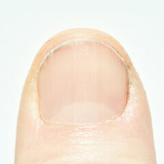 Fototapeta premium Close-up of human fingernail with dry cuticle and peeling skin.