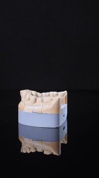 Dental stone model with layered base stands on black background while smooth band stabilizes form. Cast shows cusps grooves and contact points of fit implant used in dentistry vertical video