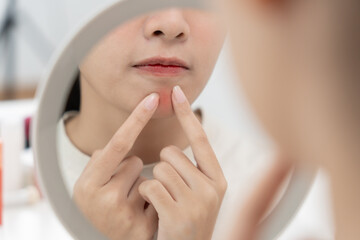 woman asian are worried about faces Dermatology and allergic to steroids in cosmetics. sensitive...