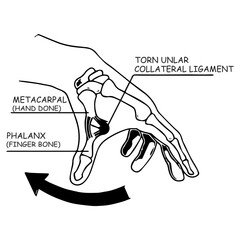 Hand Anatomy
