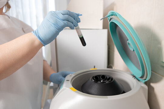 The nurse puts a tube of the patient's blood into the centrifuge. Centrifugation of blood samples, a plasma separation procedure for plasmolifting