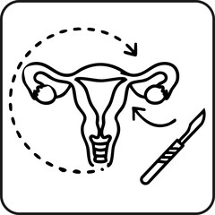 Hysterectomy