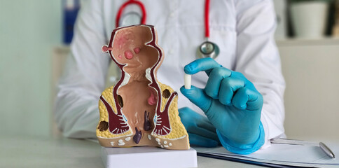 Medical suppository with laxative medicine or for treatment of proctological diseases concept