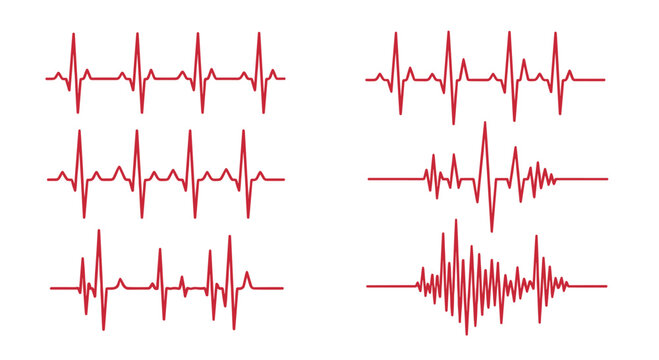 Different stylized red heartbeat lines on a white background, illustrating various normal and abnormal cardiac rhythms.