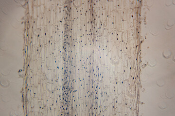 High-resolution micrograph showing the elongation zone of a plant root with elongated cells and...