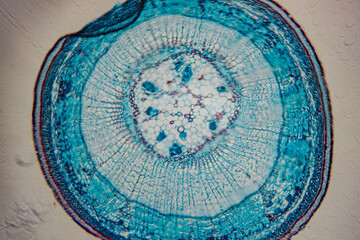 A detailed microscopic image showing a stained cross-section of a plant stem with visible vascular bundles and concentric layers of cells.