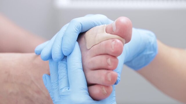 Podiatrist treating foot with toe separator in medical clinic.