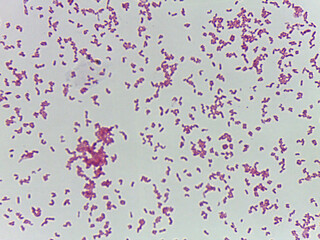 Microscopic Field of Purple Rod-Shaped Bacteria (Bacilli) Scattered on a Slideس