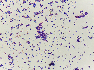Microscopic Field of Purple Rod-Shaped Bacteria (Bacilli) in Dense, Clustered Colonie