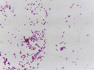 Microscopic Field of Purple Rod-Shaped Bacteria (Bacilli) in Cluster