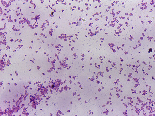 Microscopic Field of Cocci Bacteria Clustered in Tetrads and Small Group