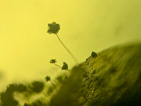 Microscopic View of Filamentous Fungi with Stalked Spore Heads