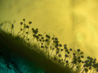 Microscopic Silhouette of Black Mold Fungi (Aspergillus niger or Rhizopus) Sporangia