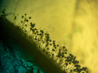 Microscopic Silhouette of Black Mold Fungi (Aspergillus niger or Rhizopus) Sporangia