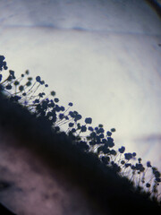 Microscopic Silhouette of Black Mold Fungi (Aspergillus niger or Rhizopus) Sporangia