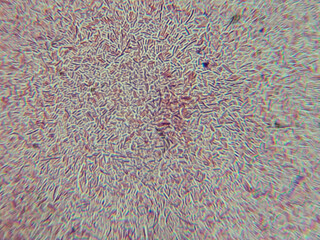 Dense Clumps of Rod-Shaped Bacteria (Bacilli) Under a Microscop