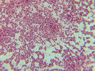 Microscopic View of Purple Cocci Bacteria Clustered in Grapelike Formation