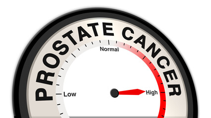 Prostate cancer severity measured on a barometer or tachometer, symbolizing advanced stages of the disease, requiring urgent medical attention, treatment, and continuous monitoring