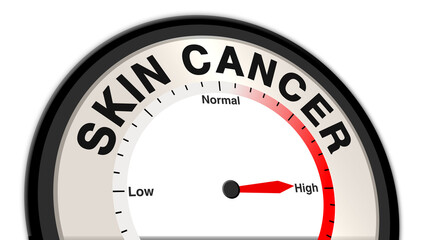 Skin cancer at a severe level shown on a barometer or tachometer, symbolizing aggressive tumors, rapid growth, and spreading, requiring urgent medical intervention, surgery, and treatment