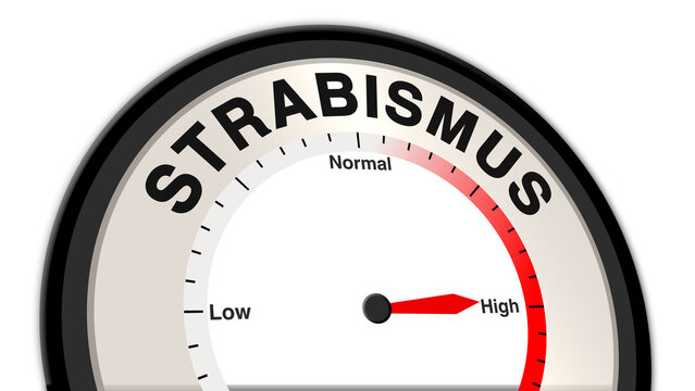 Strabismus at a severe level shown on a barometer or tachometer, symbolizing pronounced eye misalignment, requiring urgent medical intervention, therapy, and possible corrective surgery