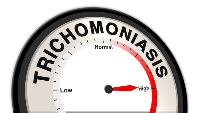 Trichomoniasis at high severity shown on a barometer or tachometer, indicating intense symptoms like painful urination, vaginal discharge, and urgent medical intervention required