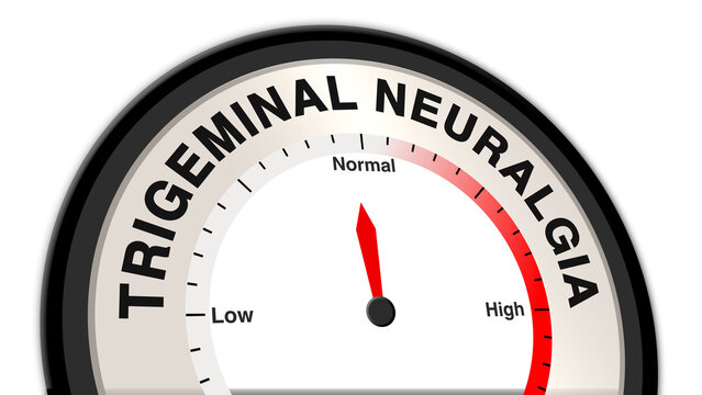 Trigeminal neuralgia at normal severity on a barometer or tachometer, showing moderate facial pain, occasional spasms, and requiring medical evaluation and management for pain control
