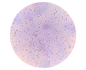 Semen analysis. Normozoospermia analyzed by microscope. Normal sperm count and morphology. 400x zoom image.