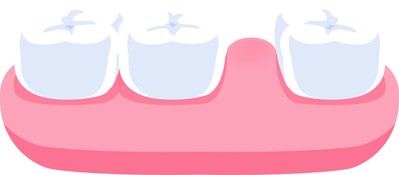 Diastema teeth illustration transparent design. Dental care concept.