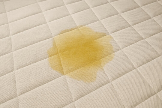 Frustrating yellow pee stain from urine on wet white mattress. bedwetting accident creating dirty mess, domestic cleaning problem on surface of bed