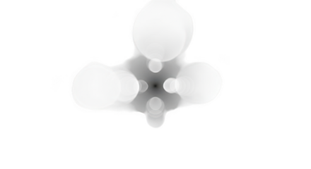 Kidney kidney stones medical imaging ct scan