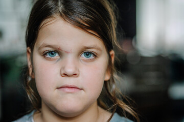 Portrait of a young girl with blue eyes and brown hair, looking directly at the camera with a...