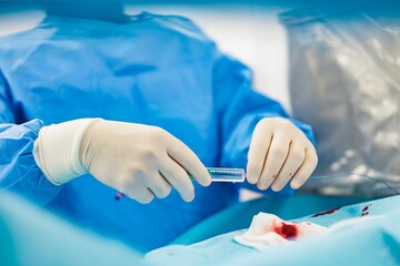 A medical professional carefully handles resorbable microspheres in a sterile surgical setting,...