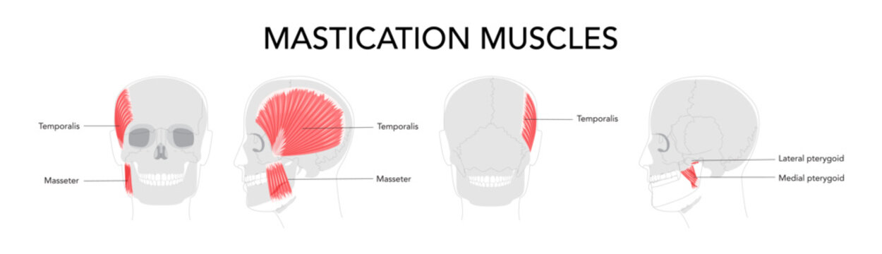 Set of Chewing muscles labeled diagram, masseter, temporalis, medial and lateral pterygoid, jaw movement, mandibular function, human head anatomy, facial expression, dentistry, clinical, scientific.