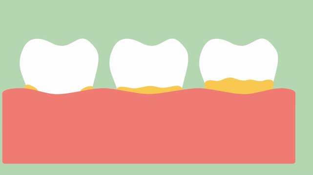 Cartoon illustration of three teeth with one showing plaque dental tooth