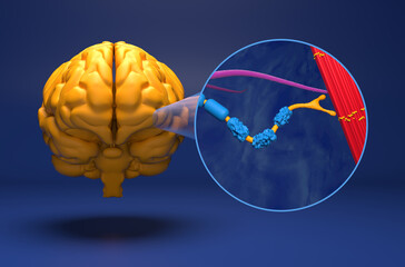 Motor neuron damaged by Amyotrophic Lateral Sclerosis (ALS) - 3d illustration closeup view