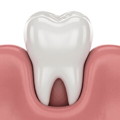 3D Realistic Render Of A Healthy White Human Molar Tooth In Pink Gum Tissue With Detailed Gingiva Texture PNG