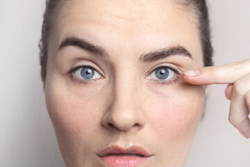 Facial asymmetry. A woman has one eyebrow higher than the other. Caucasian woman