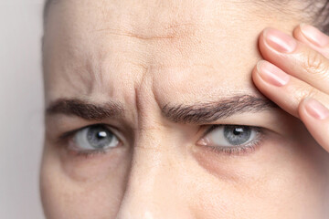 Portrait of Caucasian middle-aged woman pointing to the wrinkles on the upper eyelid forehead and bridge of nose. Signs of aging on the face close up